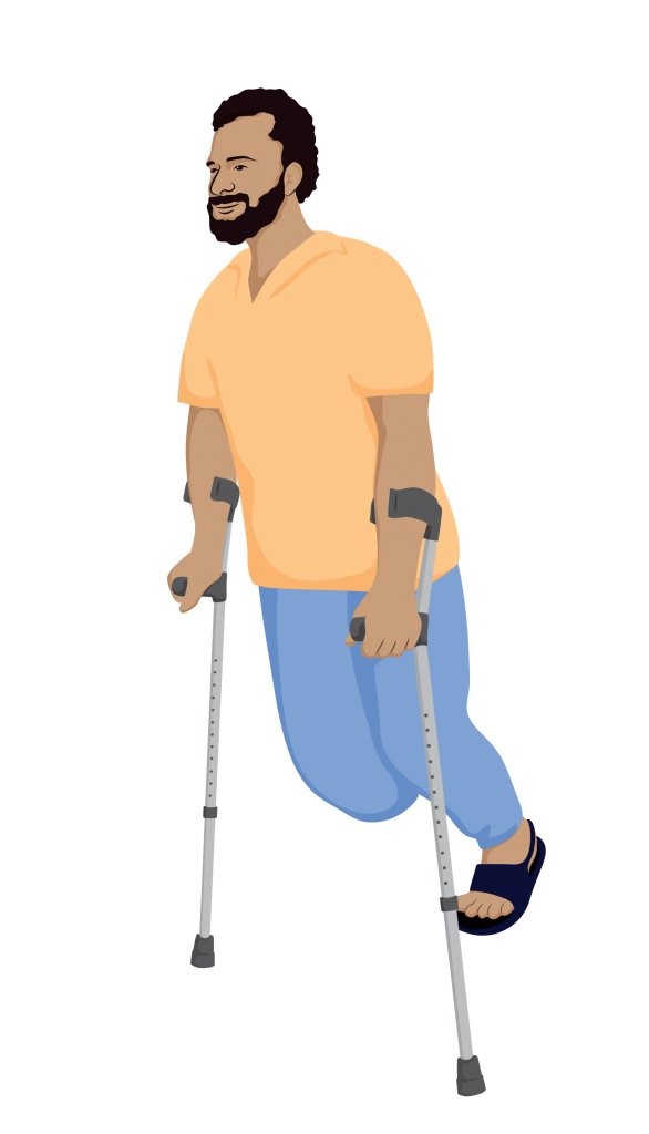 Asif using elbow crutches without prosthesis