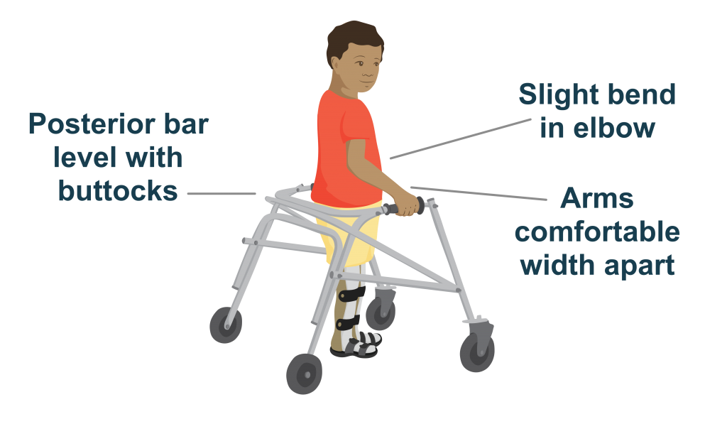 Abe using a posterior walker with important aspects of fit labeled