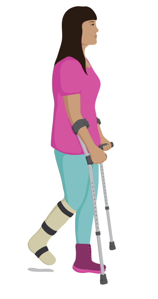 Adira with cast on leg and walking with her elbow crutches.