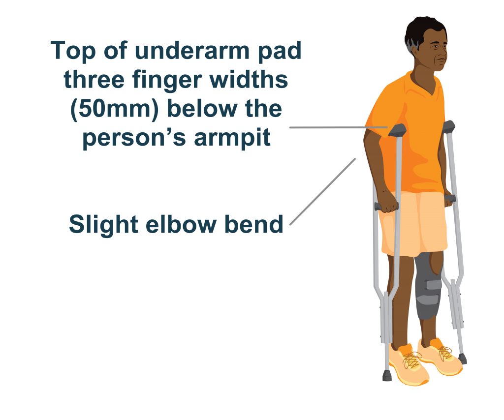 Hugo showing the gap below the armpit and slight arm ben for a well fitted axilla crutch