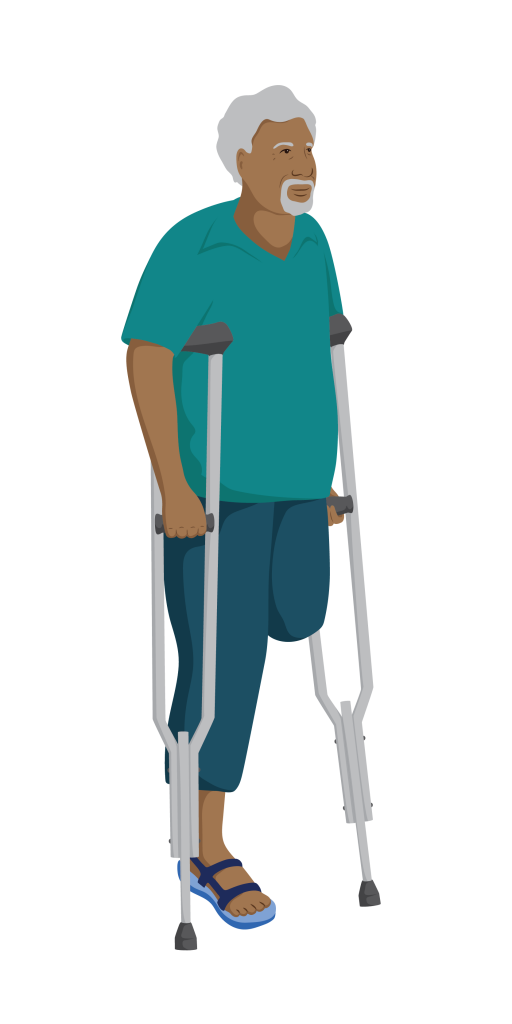 Ravi with a left leg amputation using axilla crutches to walk.