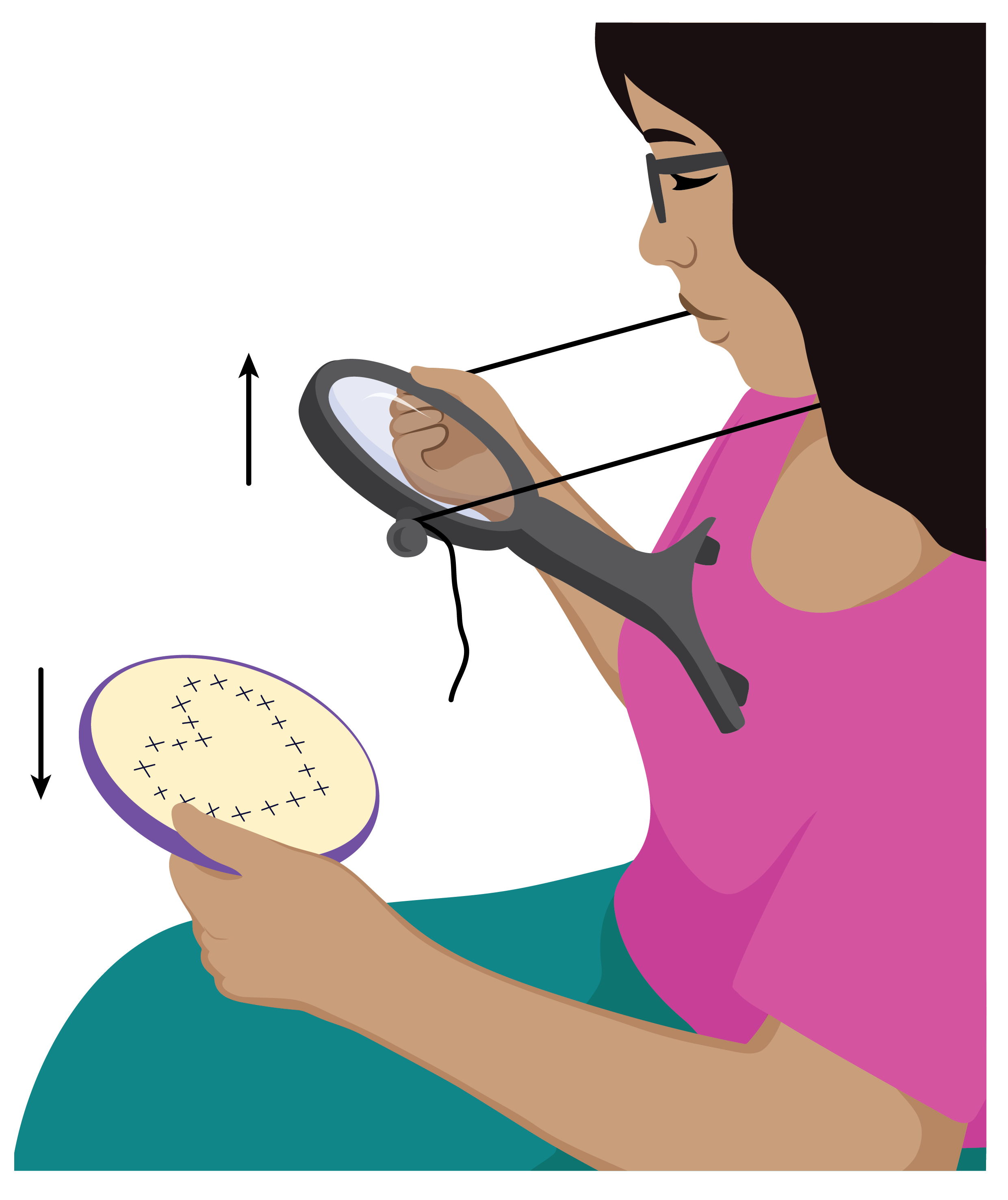 A woman wearing spectacles has an around the neck magnifier resting on her chest, with strings around her neck supporting it. She is holding it with her right hand and moving it towards her eyes. In her left hand she is holding a circle of embroidery, which she is moving downwards.