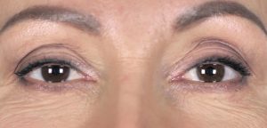 Two eyes that are clear, eyebrows look slightly raised