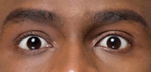 Two eyes that are clear, and are wide open