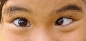 Two eyes, one stares straight ahead and one is looking inwards.