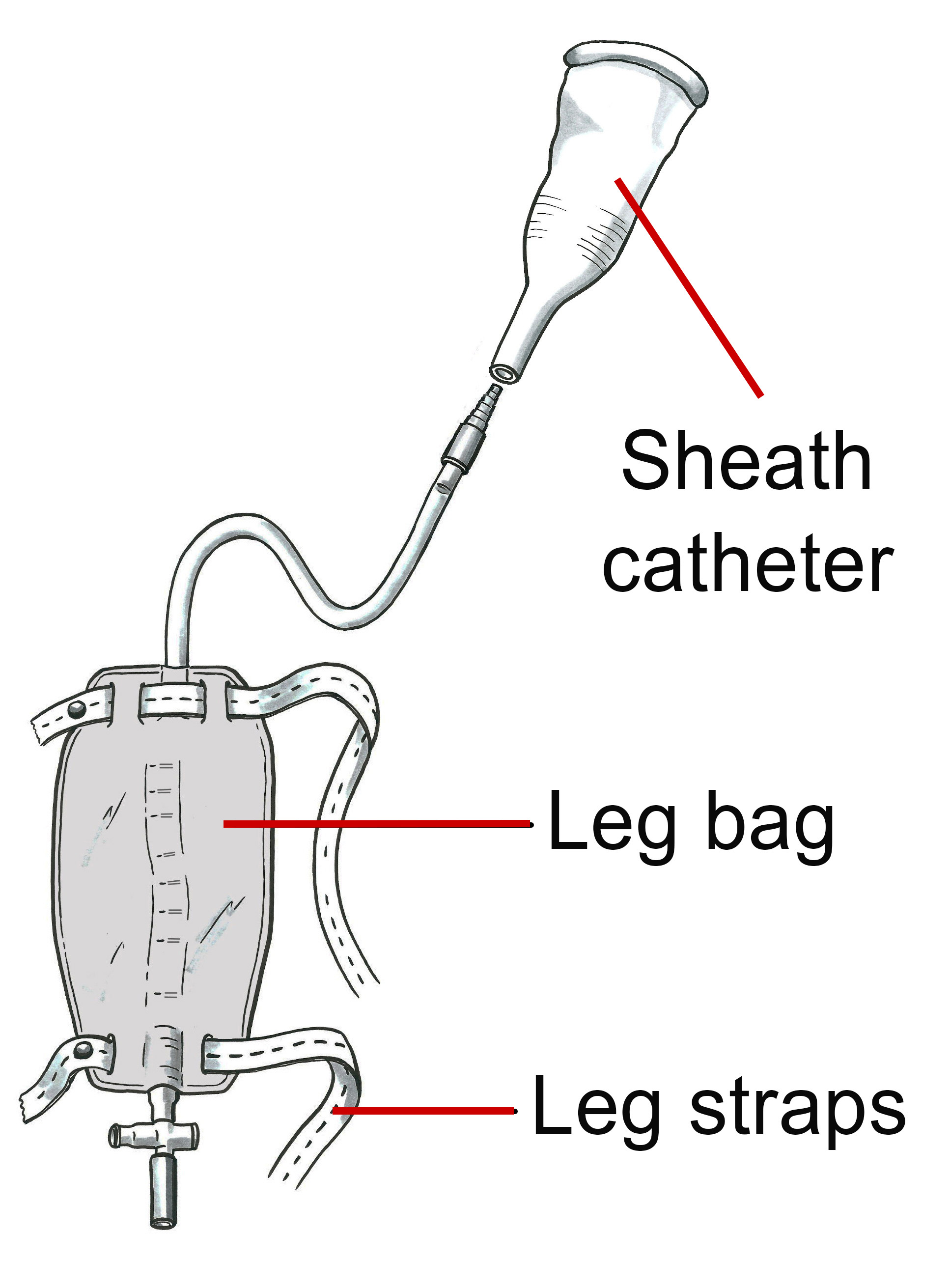 A short tube that leads into a thin bag with straps that attach it to the person’s leg, and a tap like opening at the bottom.