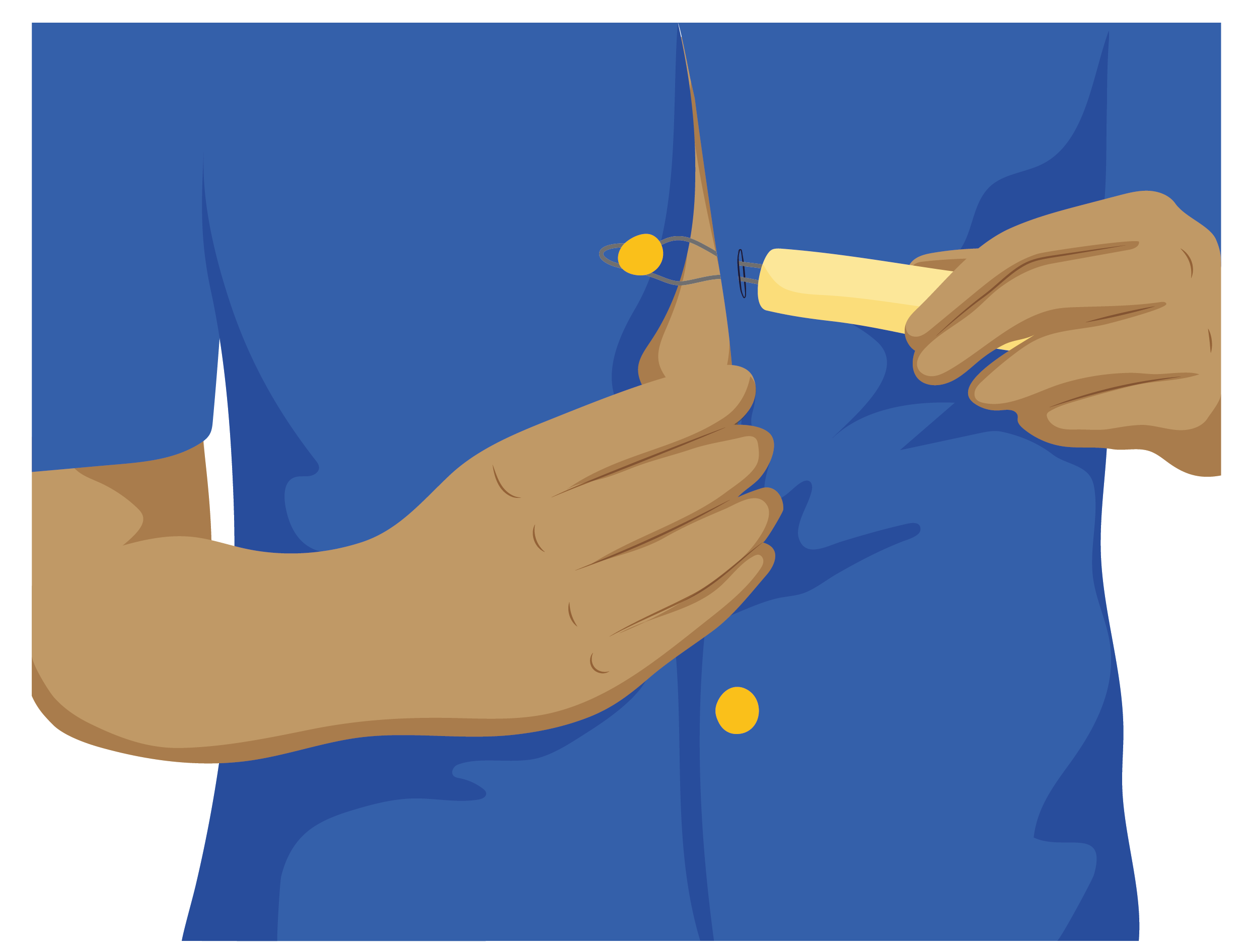 A person is using a button hook and zip puller to do up a button on shirt.