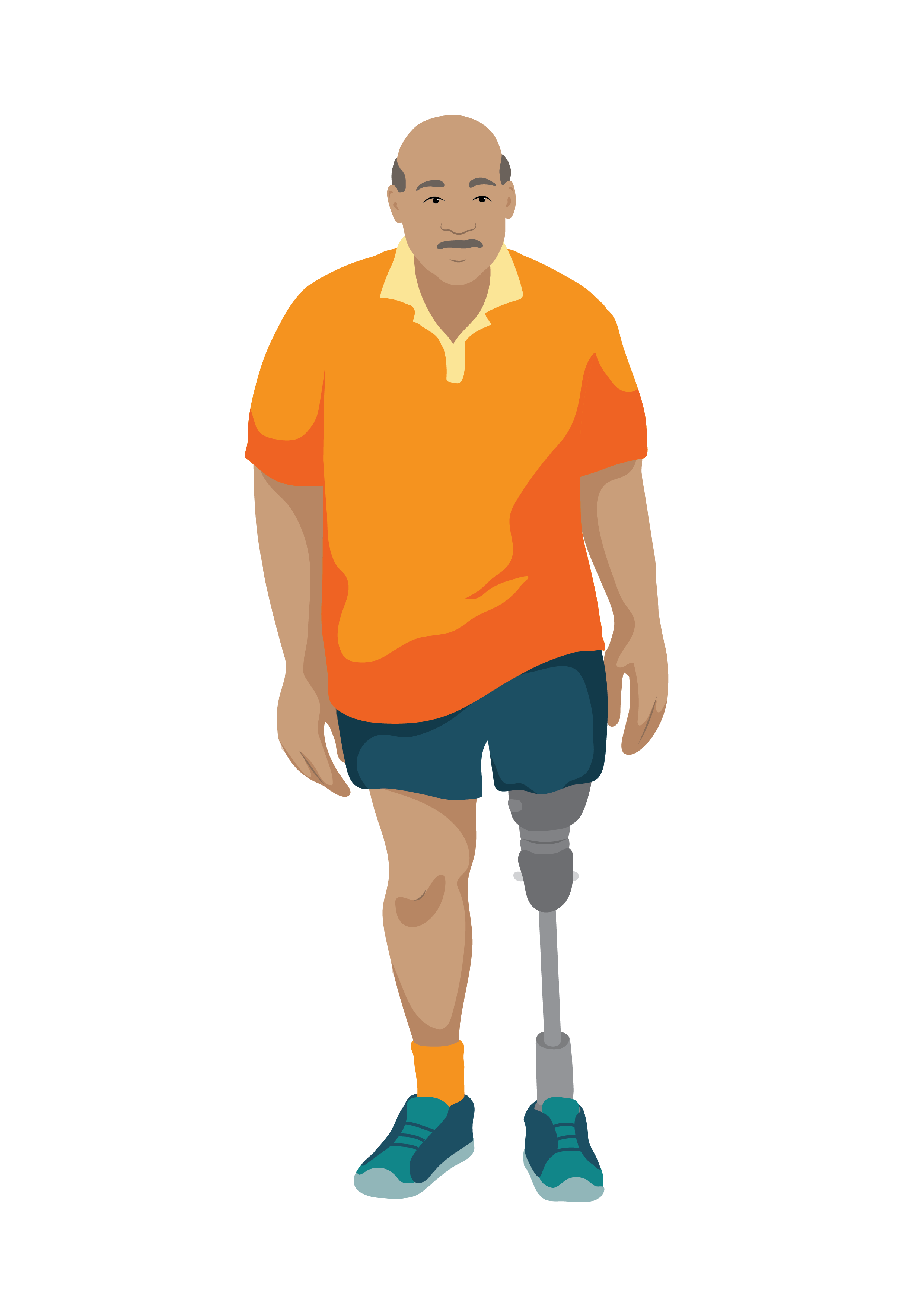 An older man using a prosthesis to stand after an above-knee amputation of his left leg.