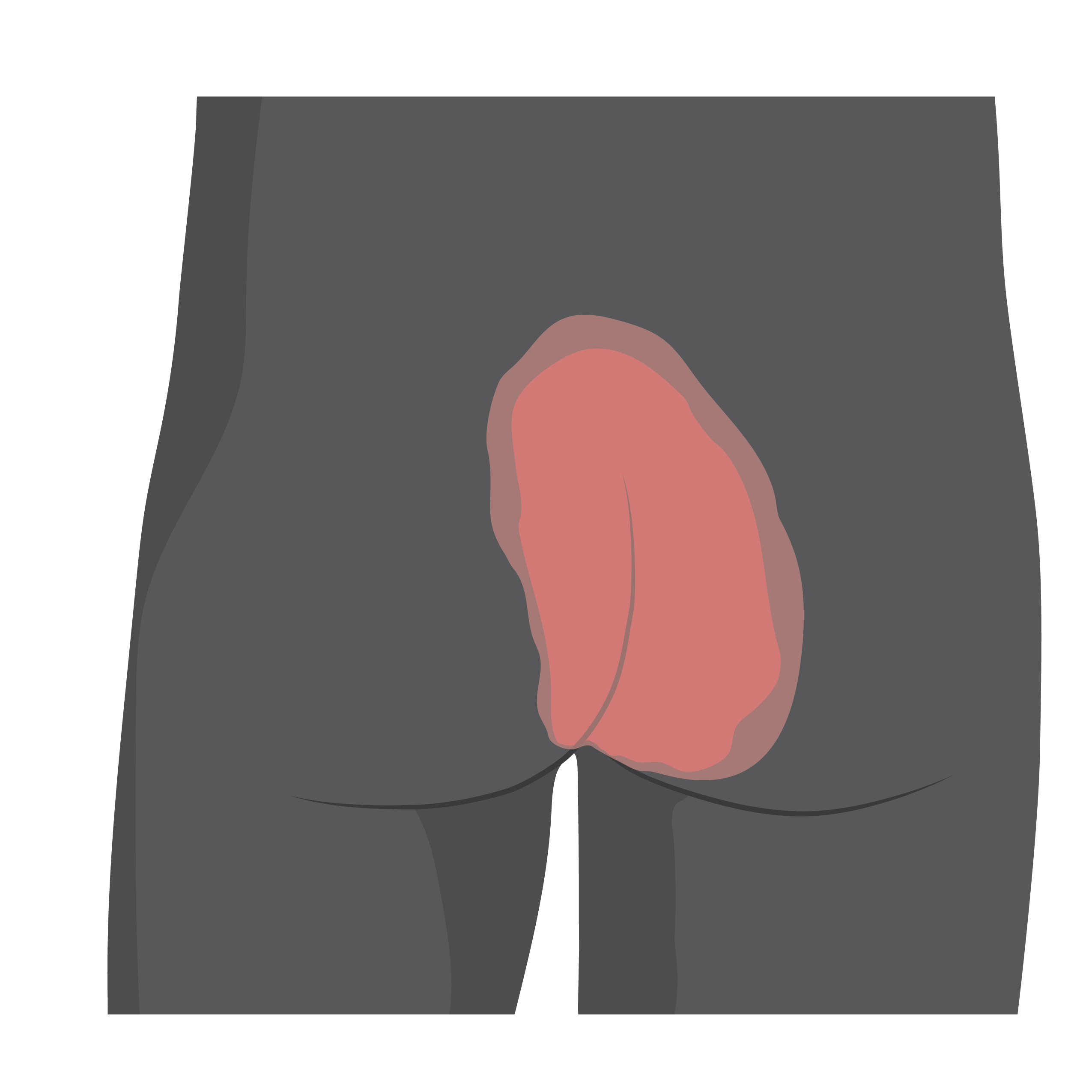 The central area of a person’s buttocks is red and irritated.