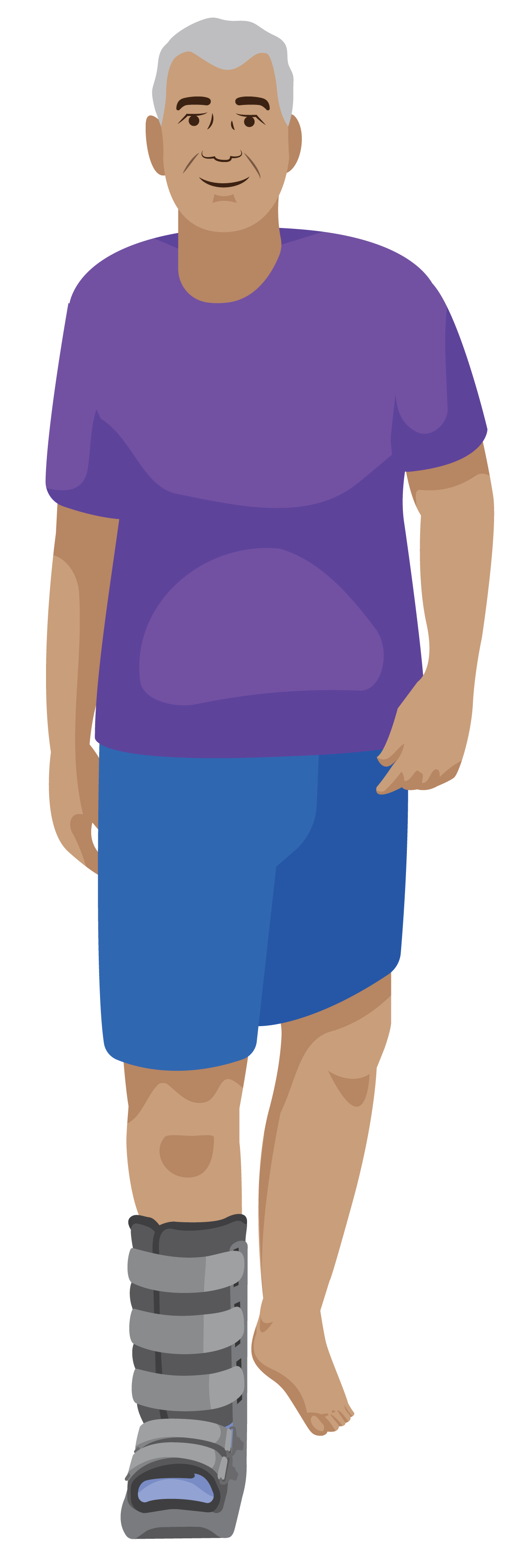 Mone walking while wearing a Rigid Removable Boot