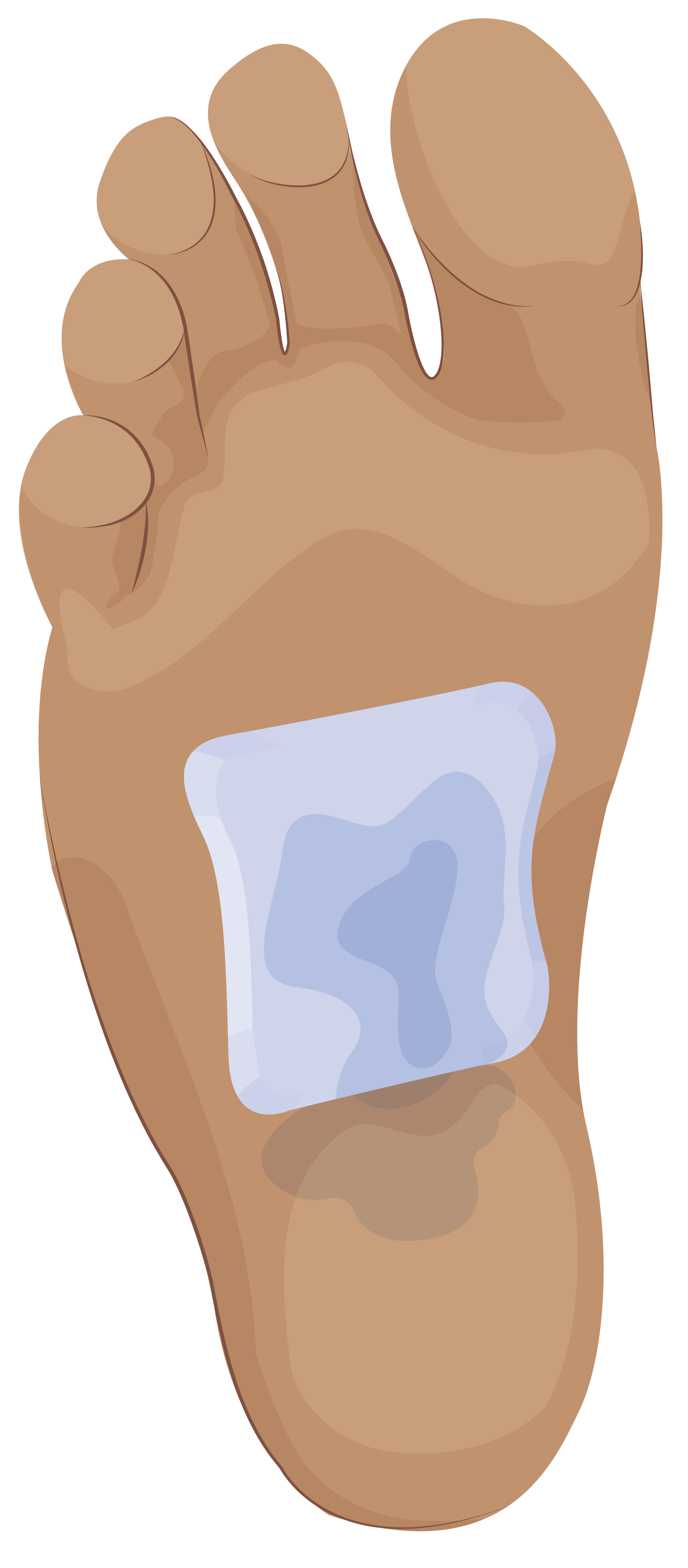 Foot wound with wet dressing