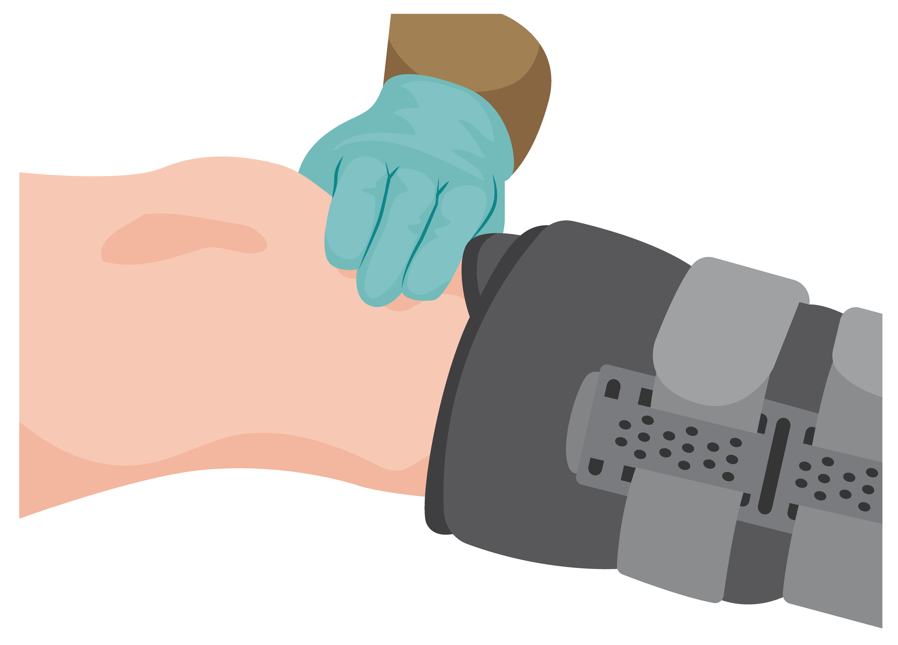 Health worker holding three fingers to person’s leg between the bottom of the knee cap and the top of the rigid removable boot