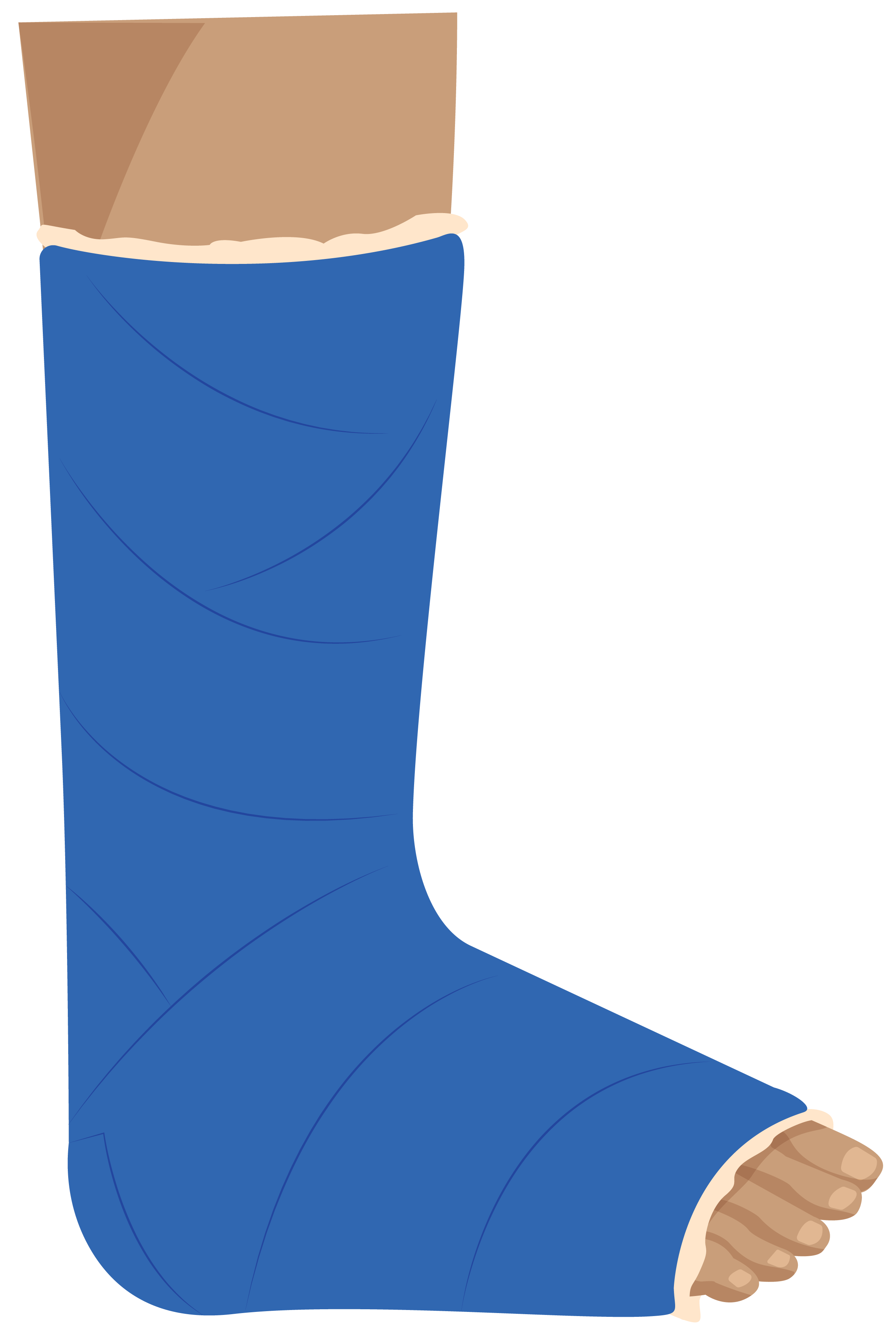 Material wrapped tightly from below the knee to the start of the toes, leaving the ends of toes exposed. Inside is a soft lining