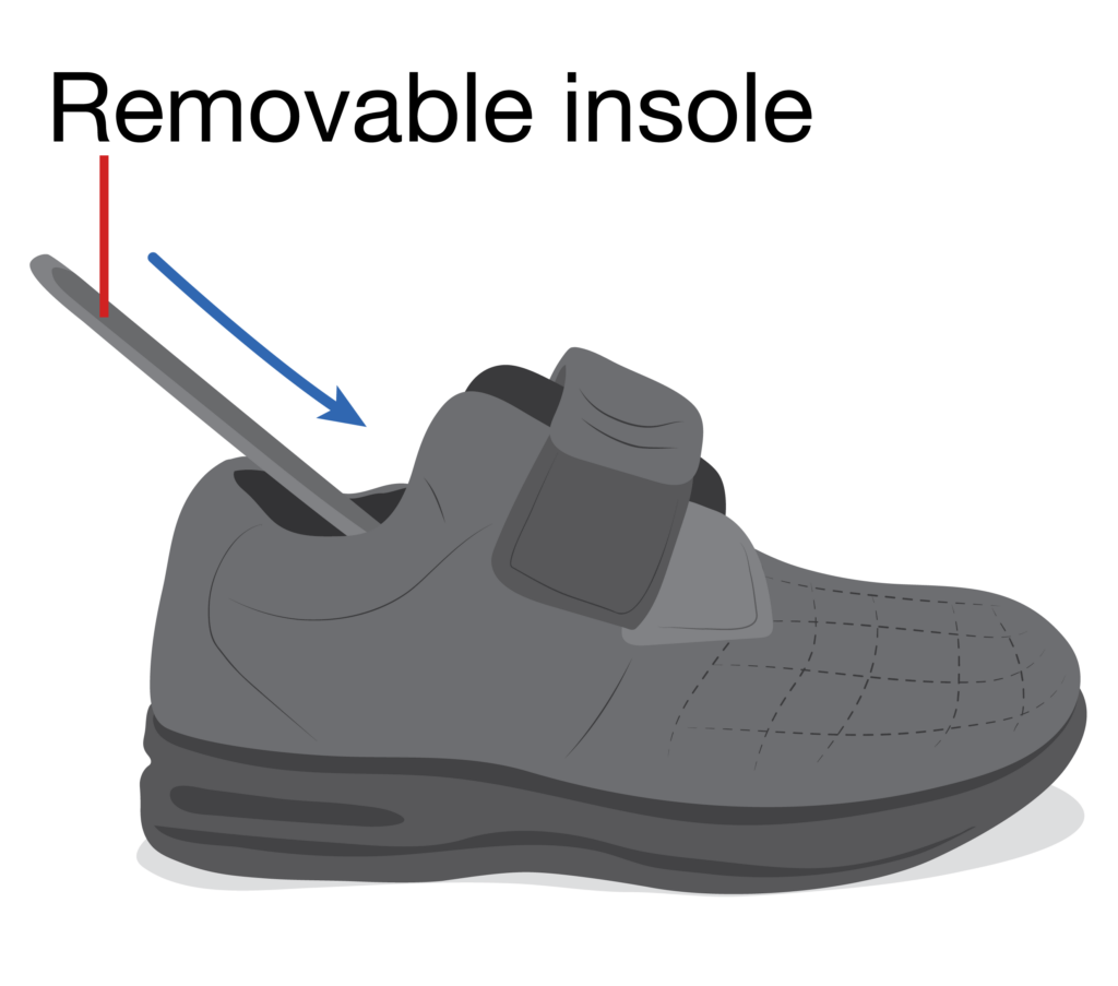 Therapeutic footwear with thin strip of rubber labeled ‘removable insole’ being put inside.