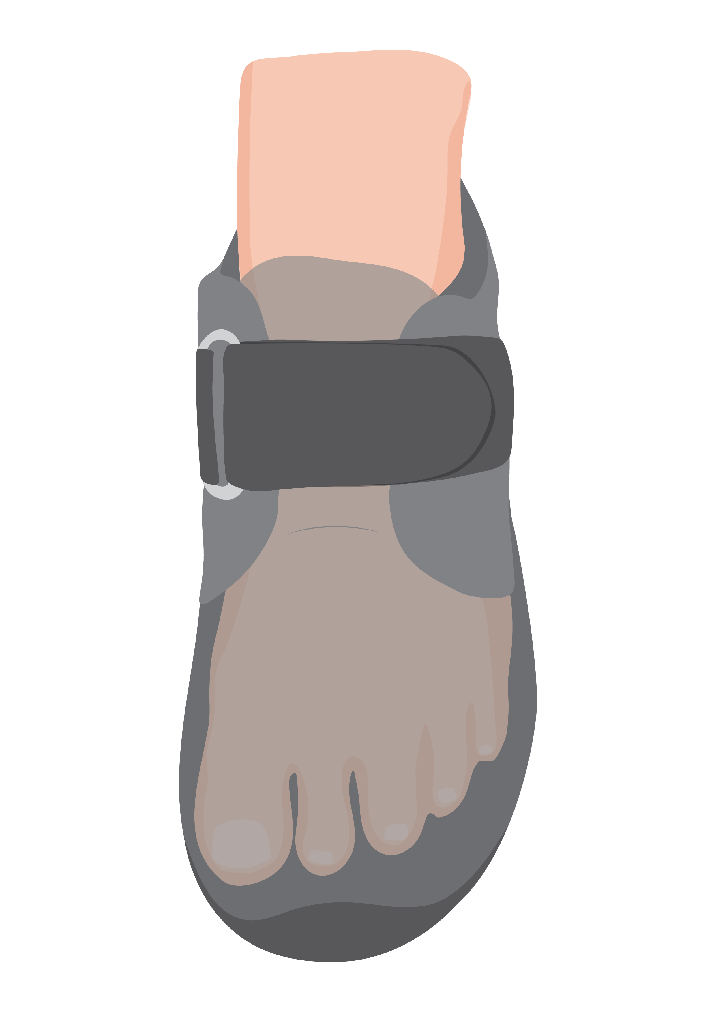 Foot inside therapeutic footwear showing a little extra space at the sides of the foot.