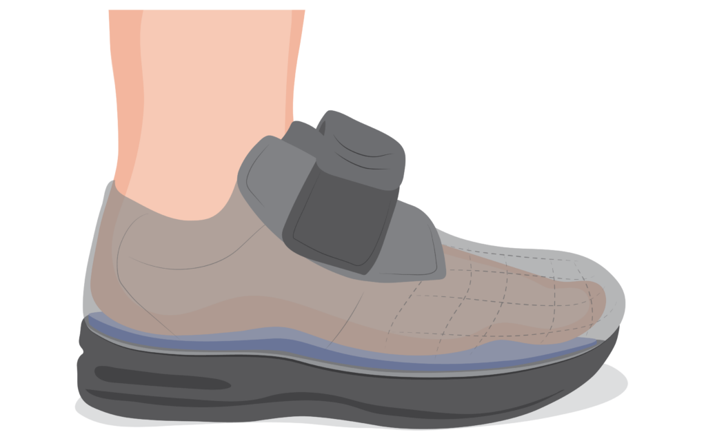 Foot inside well fitting therapeutic shoe.