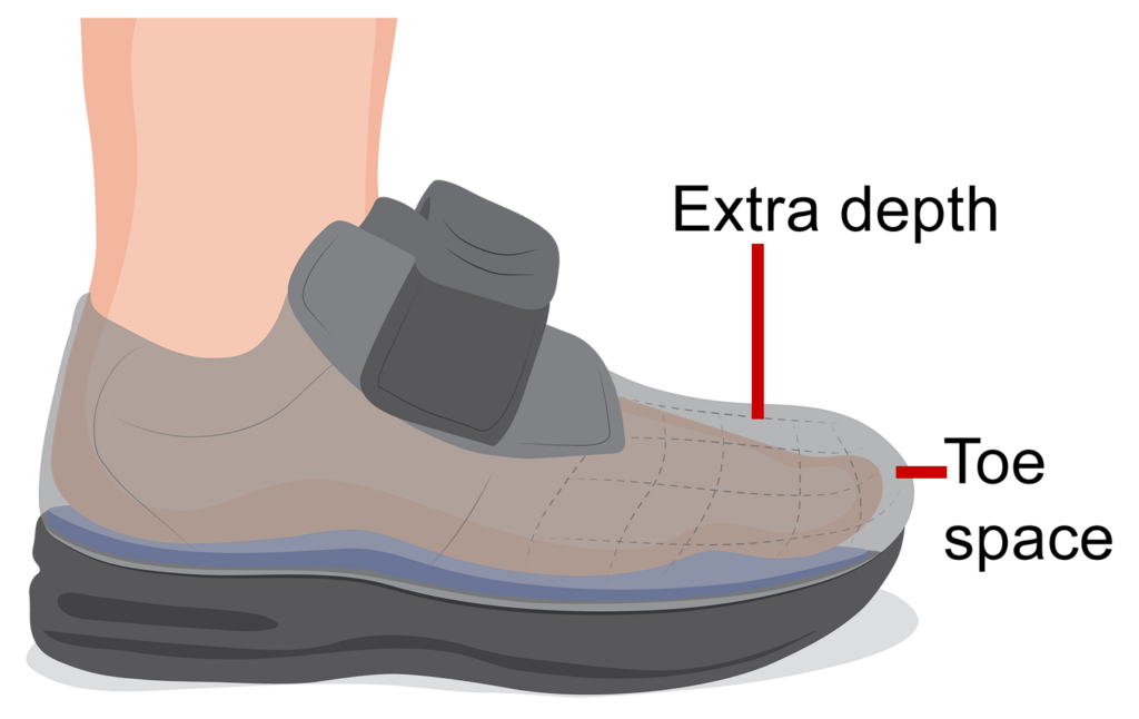 Foot inside therapeutic footwear showing extra space above and in front of toes.