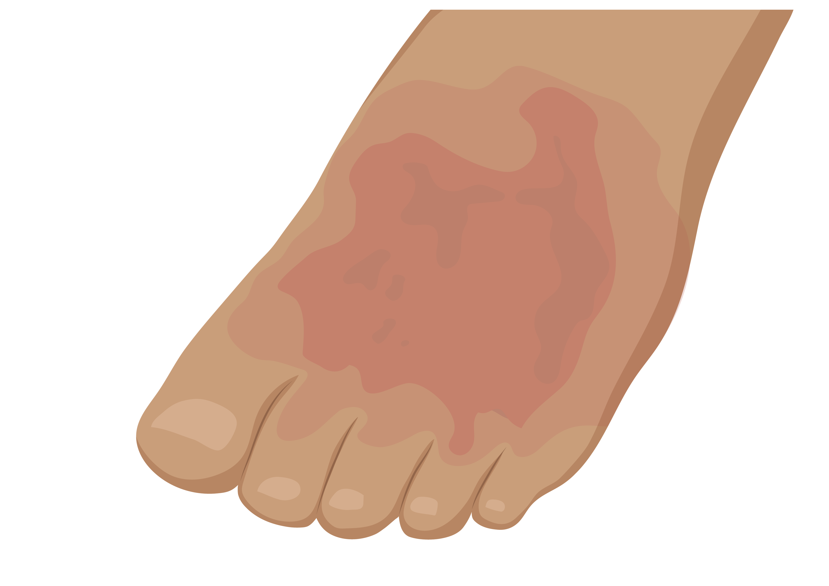 Person’s foot with red, swollen skin on the top.