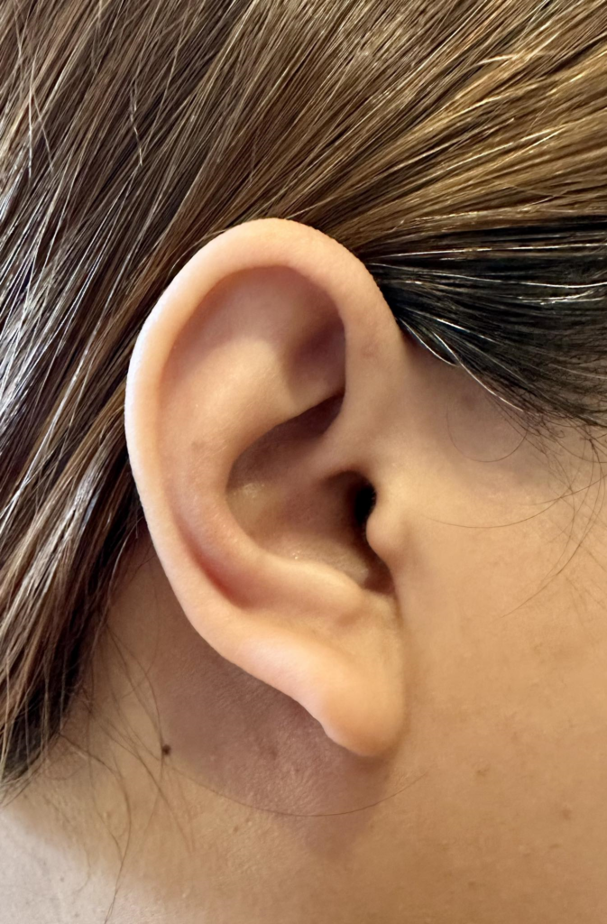 The person’s ear shape is typical. There is an ear canal. There is no sign of injury or infection.