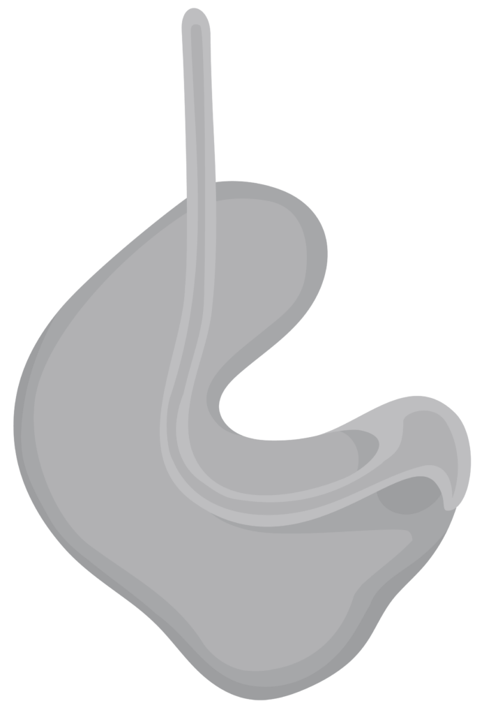 A custom earmould in the shape of a person’s unique ear shape. It has a tube attached.