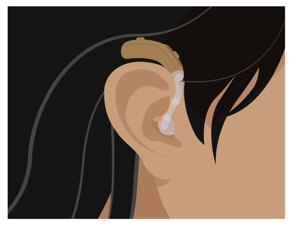 A person wearing a behind-the-ear hearing aid. The tube is short. Rear part of the hearing aid is floating above the person’s ear - it is not resting on the ear.