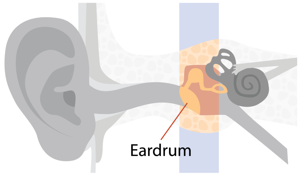 The ear canal leads to the eardrum (tympanic membrane). The eardrum separates the outer and middle ear.