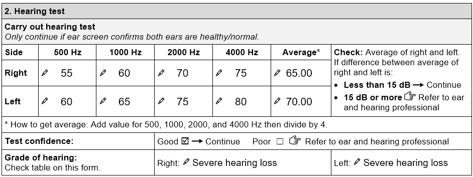 Hearing test section of the TAP Hearing aids assessment form showing John’s hearing thresholds, average and grade of hearing loss. The right ear has the following values: • 55 dB at 500 Hz • 60 dB at 1000 Hz • 70 dB at 2000 Hz • 75 dB at 4000 Hz Average is 65.00. The left ear has the following values: • 60 dB at 500Hz • 65 dB at 1000 Hz • 75 dB at 2000 Hz • 80 dB at 4000 Hz. Average is 70.00. Test confidence is ticked ‘good’. Grade of hearing loss is severe hearing loss for both right and left ears.