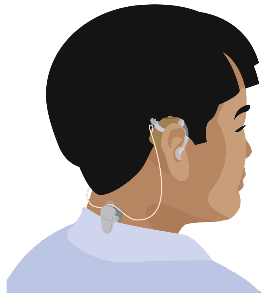 Back of child’s head with hearing aid clip attached to their collar and connected by a cord to their hearing aid. The hearing aid is placed over their ear.