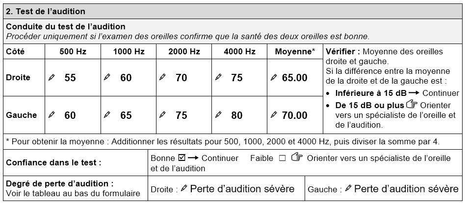 Section du formulaire TAP d'évaluation en vue de la fourniture d'une aide auditive relative au test de l'audition, montrant les seuils d'audition de John, le seuil moyen et le degré de perte d'audition. L'oreille droite présente les valeurs suivantes • 55 dB à 500 Hz • 60 dB à 1000 Hz • 70 dB à 2000 Hz • 75 dB à 4000 Hz. La moyenne est de 65 dB. L'oreille gauche présente les valeurs suivantes • 60 dB à 500 Hz • 65 dB à 1000 Hz • 75 dB à 2000 Hz • 80 dB à 4000 Hz. La moyenne est de 70 dB. La confiance dans le test est « bonne ». Le degré de perte d'audition est sévère pour les deux oreilles.